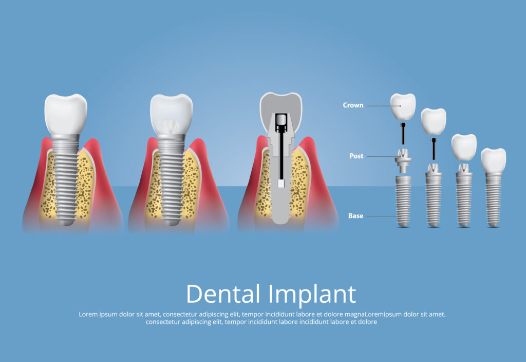Best dental hospitals in hanamkonda